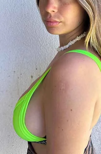 Mathilde Harstad